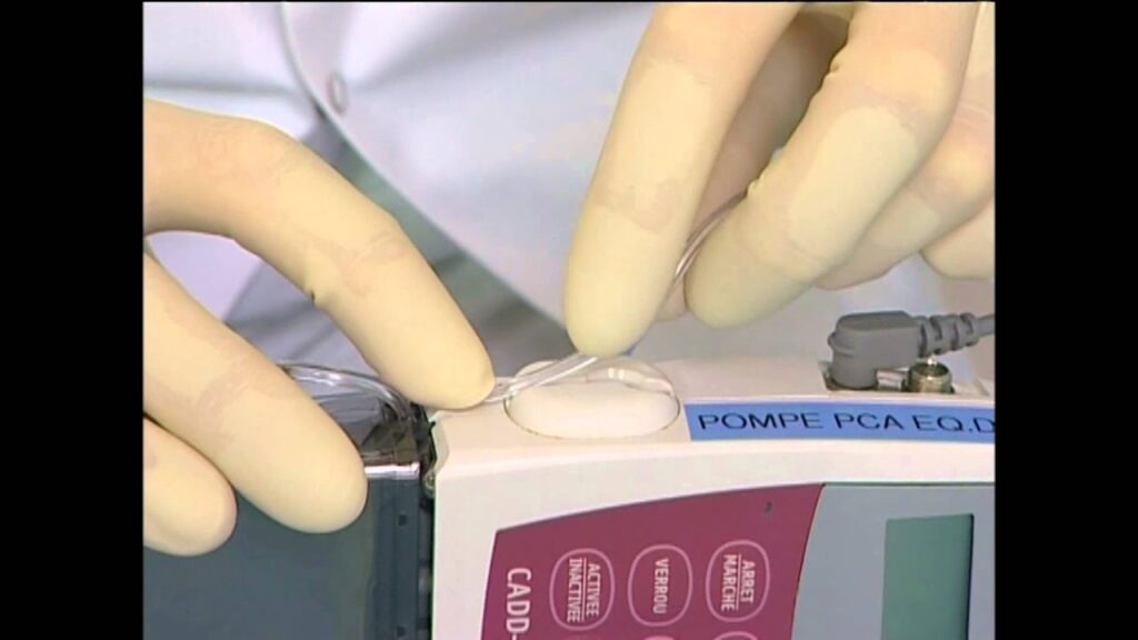 Pompe à morphine combien de temps